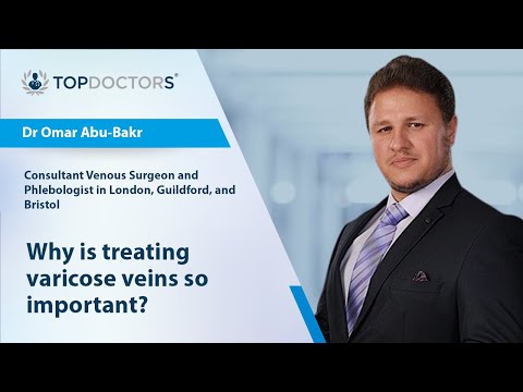 Why is treating varicose veins so important?