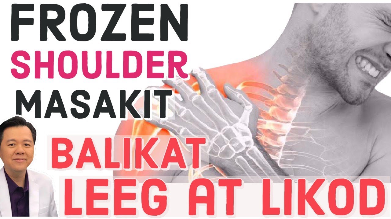 Frozen Shoulder: Masakit ang Leeg, Balikat at Likod Tips ni Doc Willie & Doc Liza