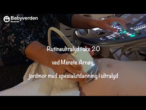 Video: Hvornår kan svangerskabssækken ses ved ultralyd?