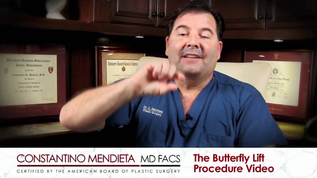 Miami Butterfly Lift Dr. Mendieta YouTube