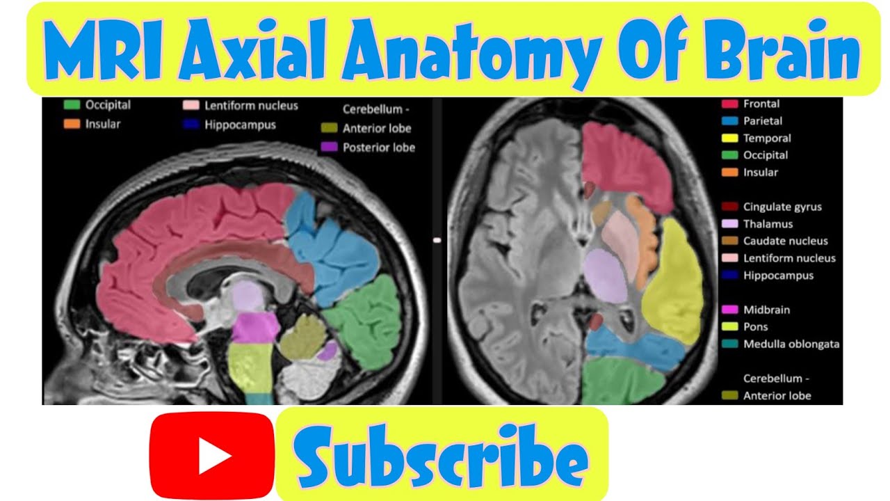 MRI Brain Axial Anatomy mri mribrain mrianatomy axialbrain YouTube