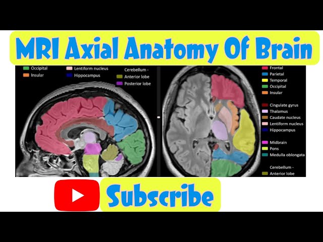 Mri Anatomy Free Mri Axial Brain Anatomy 1280x660