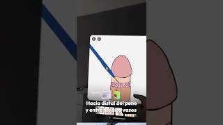 Te Explico Como Se Realiza Una Circuncision