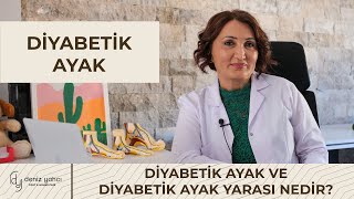 Diyabetik Ayak ve Diyabetik Ayak Yarası Nedir?