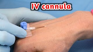 شاهد وتعلم طريقة تركيب الكانيولا _ IV cannulation procedure