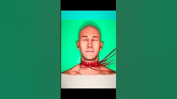 Thumbnail of full body transplant explained (3D Animation) #shorts