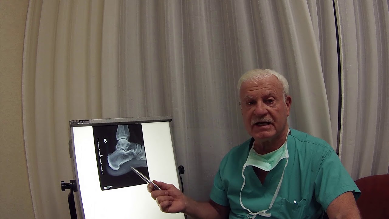 La rubrica del Professor Sandro Rossetti: Spina Calcaneare