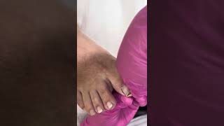 видео: Обработка вросшего ногтя  #вросшийноготь #подолог #подология #тампонада  #фруктовыйпедикюр  картинка: Обработка вросшего ногтя  #вросшийноготь #подолог #подология #тампонада  #фруктовыйпедикюр