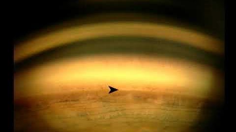 Gonioscopy - Normal Angle - 2