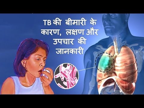 Tuberculosis के कारण, लक्षण और उपचार – Tuberculosis Causes Symptoms & Treatment in Hindi