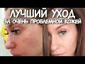 Как БЫСТРО убрать ПРЫЩИ и Черные Точки / УХОД за ПРОБЛЕМНОЙ КОЖЕЙ / Избавиться от прыщей за 2 недели