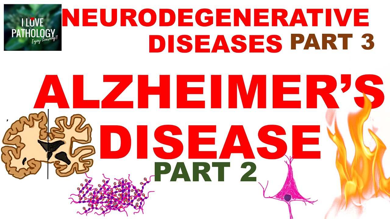 NEURODEGENERATIVE DISEASES PART 3: ALZHEIMER DISEASE- Morphology, Clinical Features & Treatment