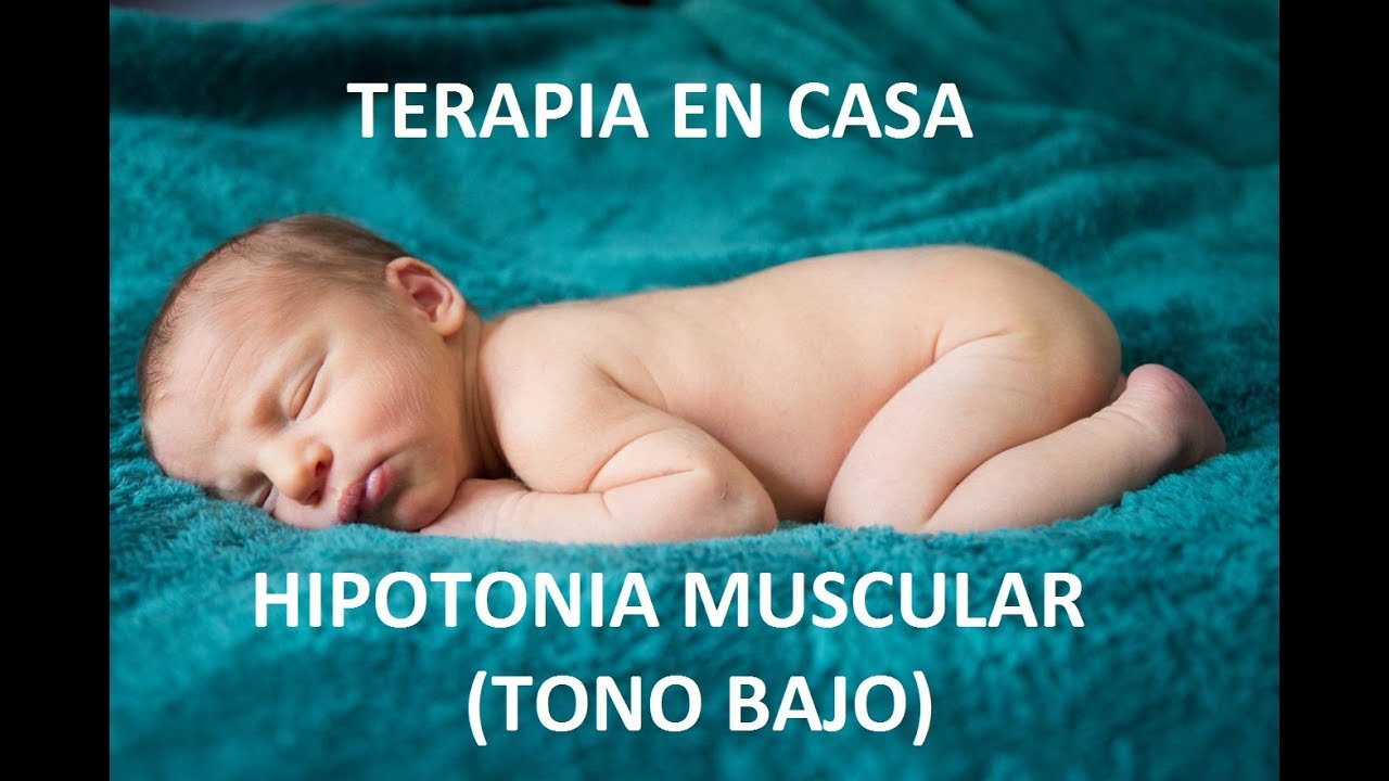 Que es una hipertonia muscular