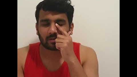 Tibial Nail Removal Recovery Video.