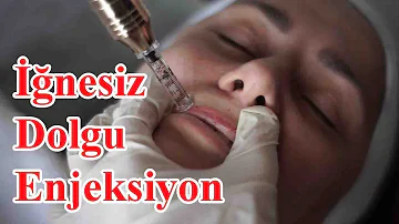 İğnesiz Enjeksiyon Dudak Dolgusu Nasıl Uygulanır ?