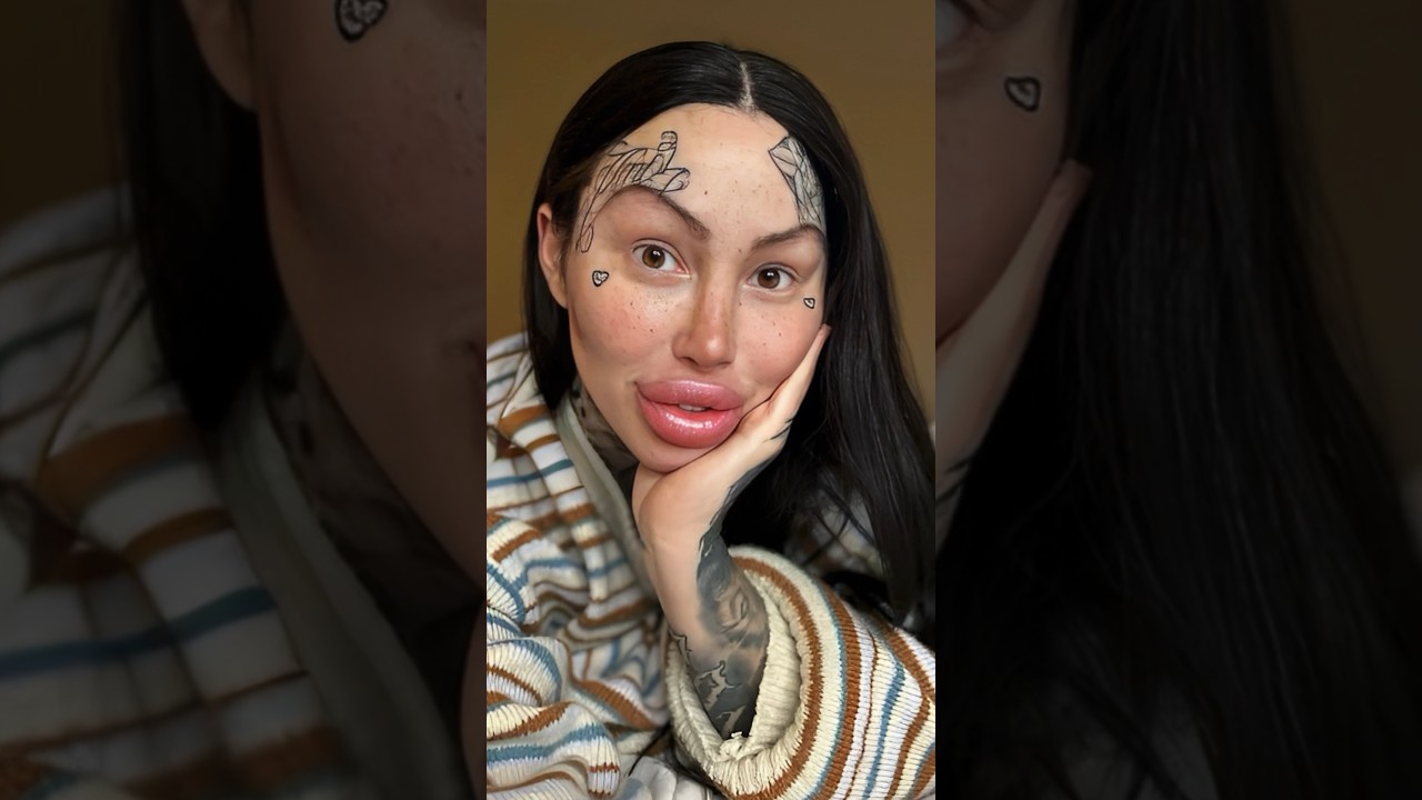 Real plastic surgery incident epicj tamil marymagdelene YouTube