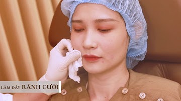 Quy Trình Tiêm Fillers Tại Viện Thẩm Mỹ Lucky