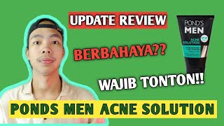 HILANGKAN JERAWAT DALAM 3 HARI | REVIEW PONDS ACNE SOLUTION | Tips Mengatasi jerawat | ine wiana