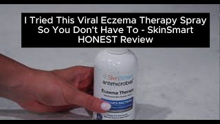 I Tried This Viral Eczema Therapy Spray So You Don't Have To - SkinSmart HONEST Review!