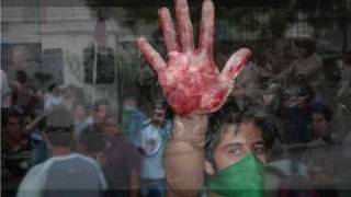 Iran  protest زده شعله در چمن