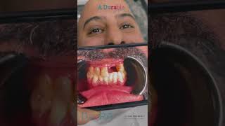 Best Dental implants Clinic In İstanbul