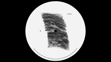 PREMIERE: TM404 & Echologist - Bass Desires [Kynant Records]