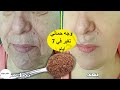 أقوى بوتوكس حتى لو عمرك70ضعيها على التجاعيد,سيجعل وجهك مشدود كالزجاج,وستختفي التجاعيد فورا كأنك شابة