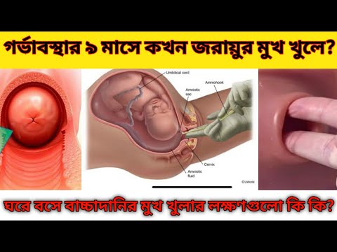 ভিডিও: 9 সপ্তাহে আমার জরায়ু কত বড়?