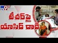 Acid attack on school teacher in Hyderabad