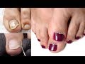 Summer Pedicure | Transformation | Hardware Pedicure