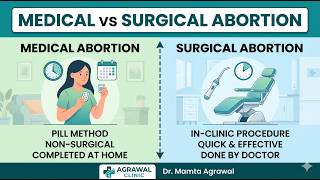 Medical vs Surgical Abortion | Which is Better? 🤔