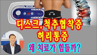 E58 디스크, 척추협착증 허리통증은 왜 치료가 힘들까 허리디스크 협착증