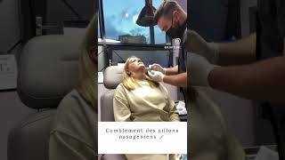 #injection #medecineesthetique #injection_video  #filler #fillersinjection #acidehyaluronique