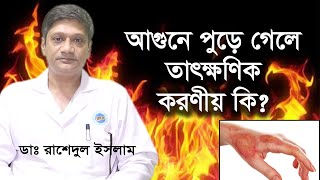 আগুনে পুড়ে গেলে প্রাথমিক চিকিৎসা | আগুনে পুড়ে গেলে তাৎক্ষনিকভাবে করণীয় | Dr. Rashedul Islam screenshot 3