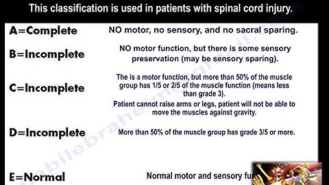 Spinal cord injury , ASIA Classification - Everything You Need To Know - Dr. Nabil Ebraheim