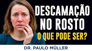 Descamação no Rosto - O Que Pode Ser?