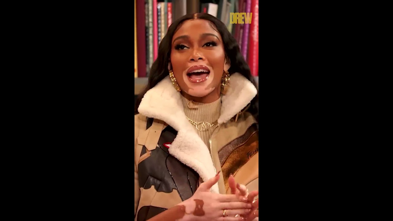 Winnie Harlow Reveals A Secret About Beyonc Shorts