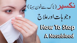 Nakseer Naak Se Khoon Aane Ka ilaj || Nose Bleeding || Nakseer Ka ilaj || Pak Health Tips