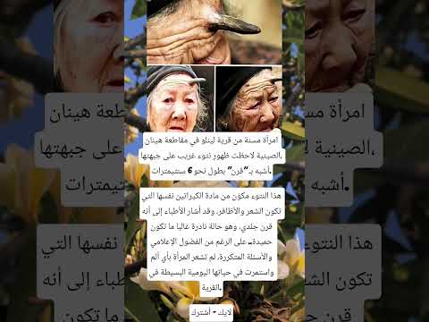 امرأة مسنة من قرية لينلو اكسبلور ذواقه اقنباسات ترند ترند تيك توك معلومات خيل علم النفس لا 