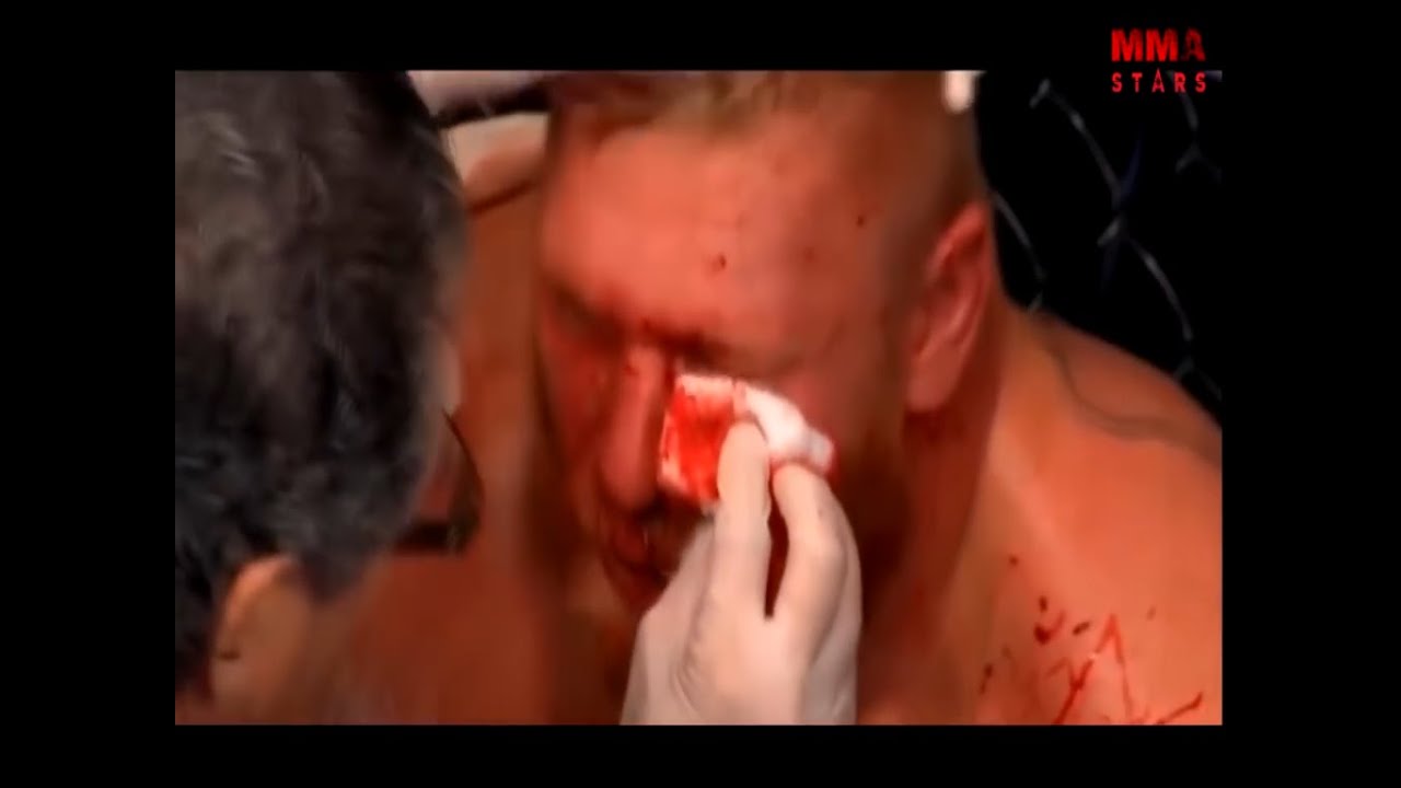 Brock Lesnar vs Conor McGregor  FIGHT comparison in 1080p.