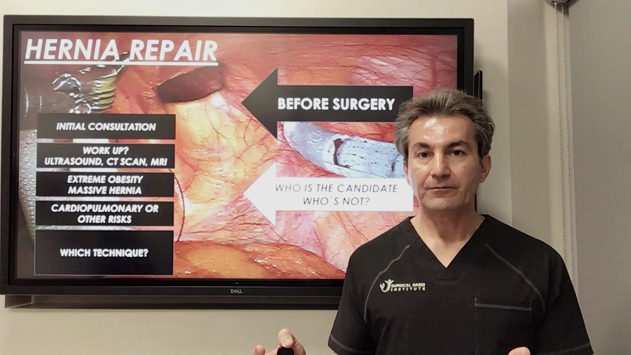 What to expect before hernia surgery by Dr. Iraniha YouTube