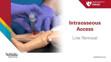 Intraosseous Access - Line Removal