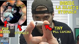 A Visual Look Inside L.A. Beast's STOMACH (Using A Camera Pill) | After Eating Pop Rocks & Coca Cola