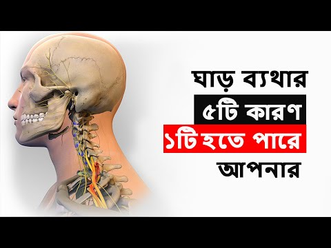 ভিডিও: কেন হরিণের ঘাড়ে গুলি পড়ে?