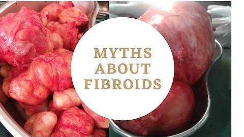 Fibroids - what are they? What causes them ? Signs and symptoms? How to treat them
