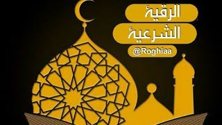 علائم سحر وجادو  نشانه افرادمسحور  #جادو