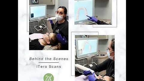 Behind the Scenes - iTero Scans