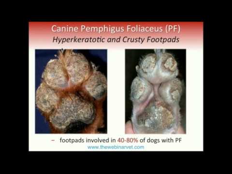 Pemphigus Foliaceus – Recent update on Pathogenesis Diagnostic and Treatment
