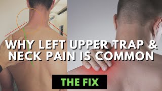 The Curious & Common Case of Left Upper Trap and Neck Tightness - The Fix screenshot 5