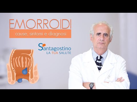 Video: Cosa Sono Le Emorroidi E Come Le Tratti?